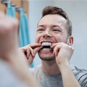 Clear Aligners