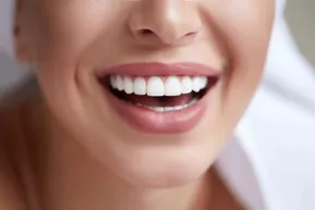 Dental bonding treatment