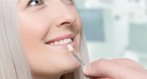 Porcelain veneers